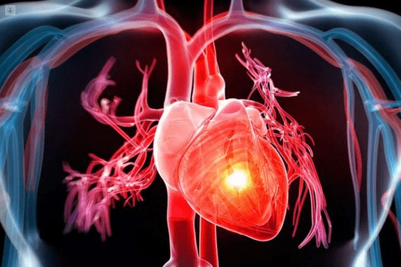 Cardiólogo cerca de mi